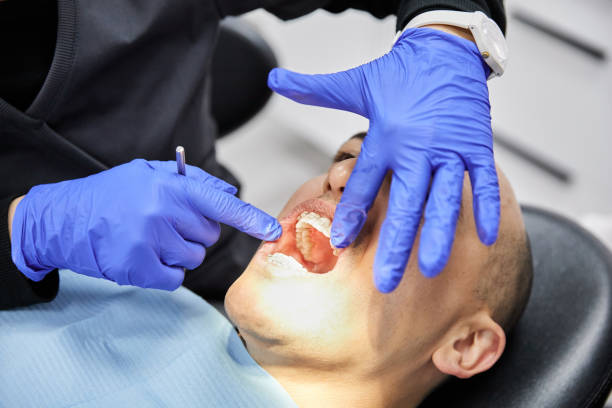 Best Knocked-Out Tooth (Avulsed Tooth) Treatment in South Coatesville, PA