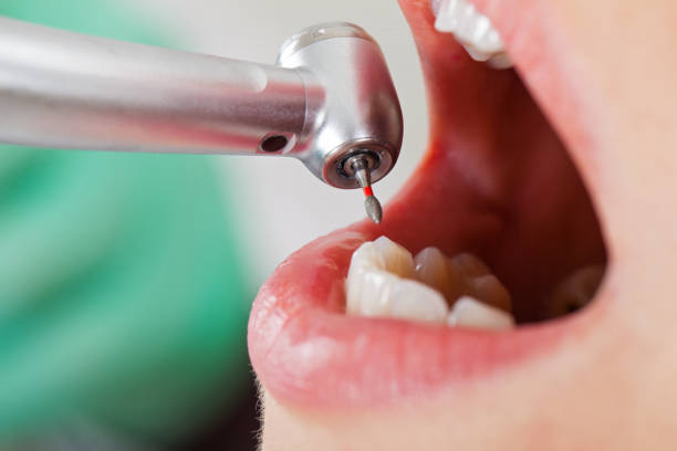 Best Emergency Treatment for Oral Infections in South Coatesville, PA